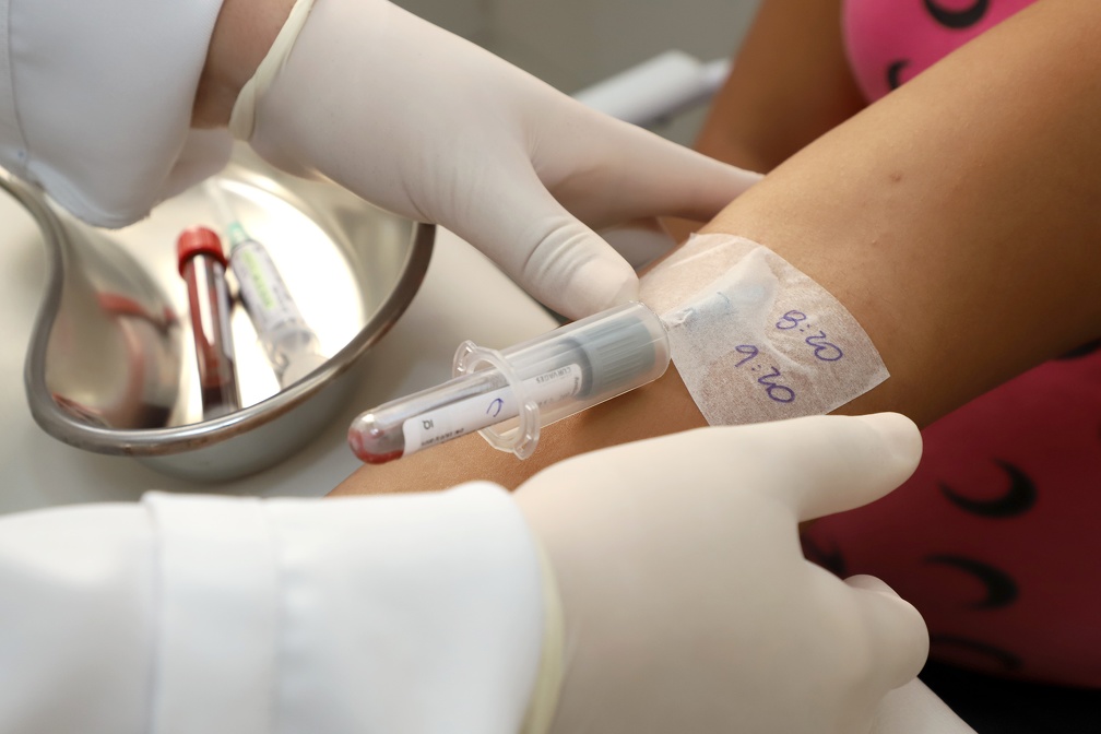 Paciente durante exame de curva glicêmica de uma hora no Laboratório Municipal