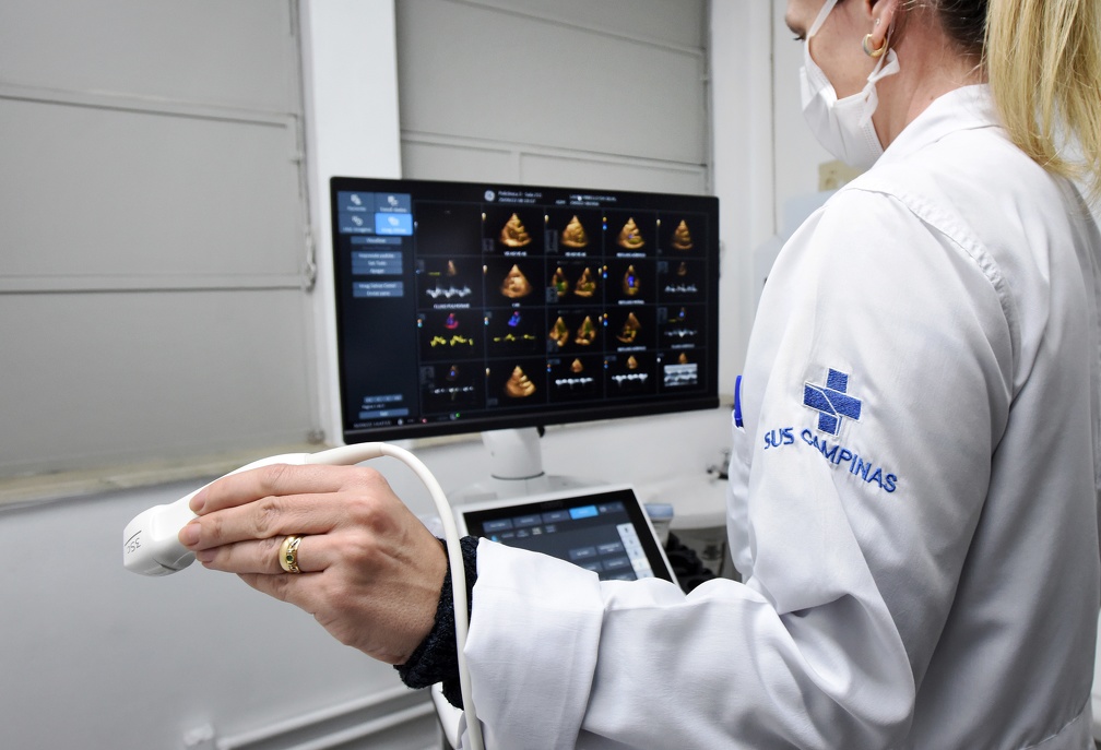 Ultrassons no SUS Municipal tiveram filas reduzidas nos últimos anos