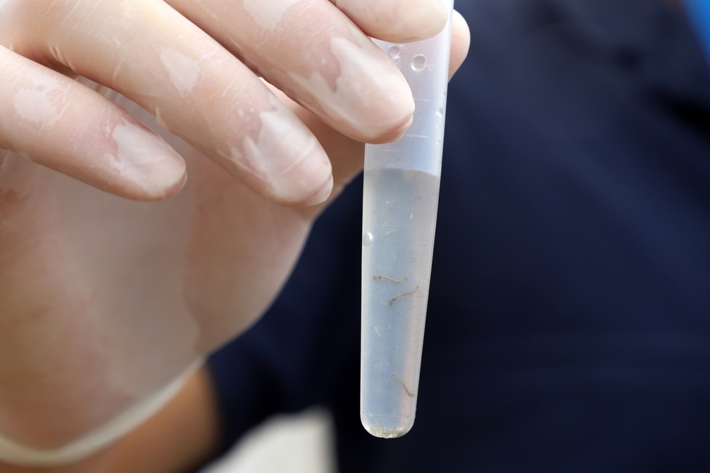 Imagem mostra água com larvas do Aedes aegypti, vetor da dengue