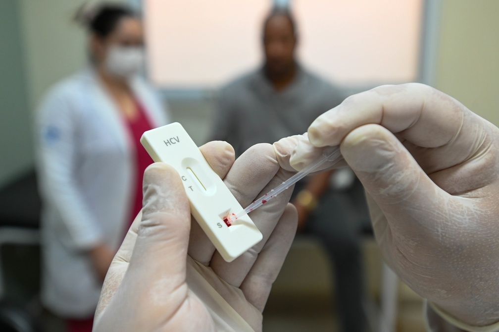 Testes rápidos para hepatites B e C estão disponíveis nos centros de saúde