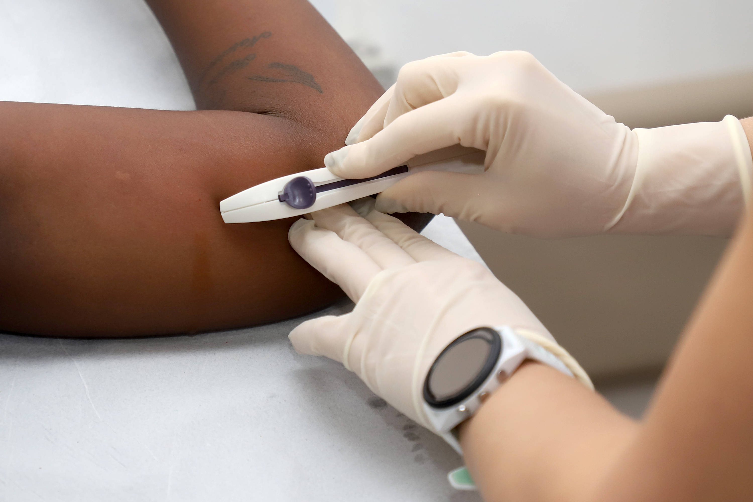 O implante é um método contraceptivo de longa duração