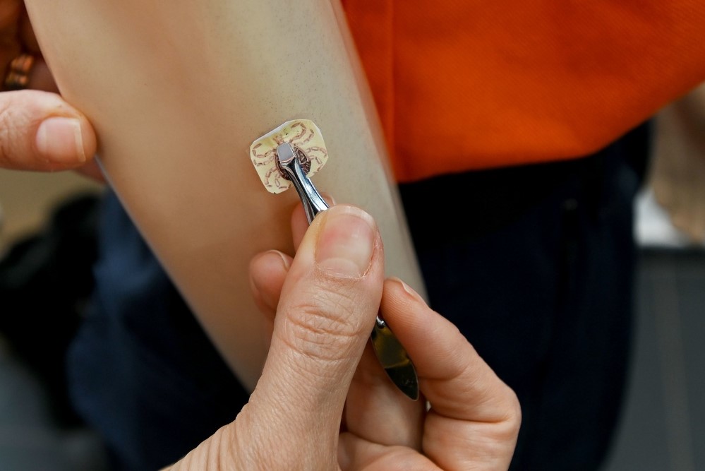 Febre maculosa é causada por bactéria transmitida pela picada do carrapato-estrela infectado