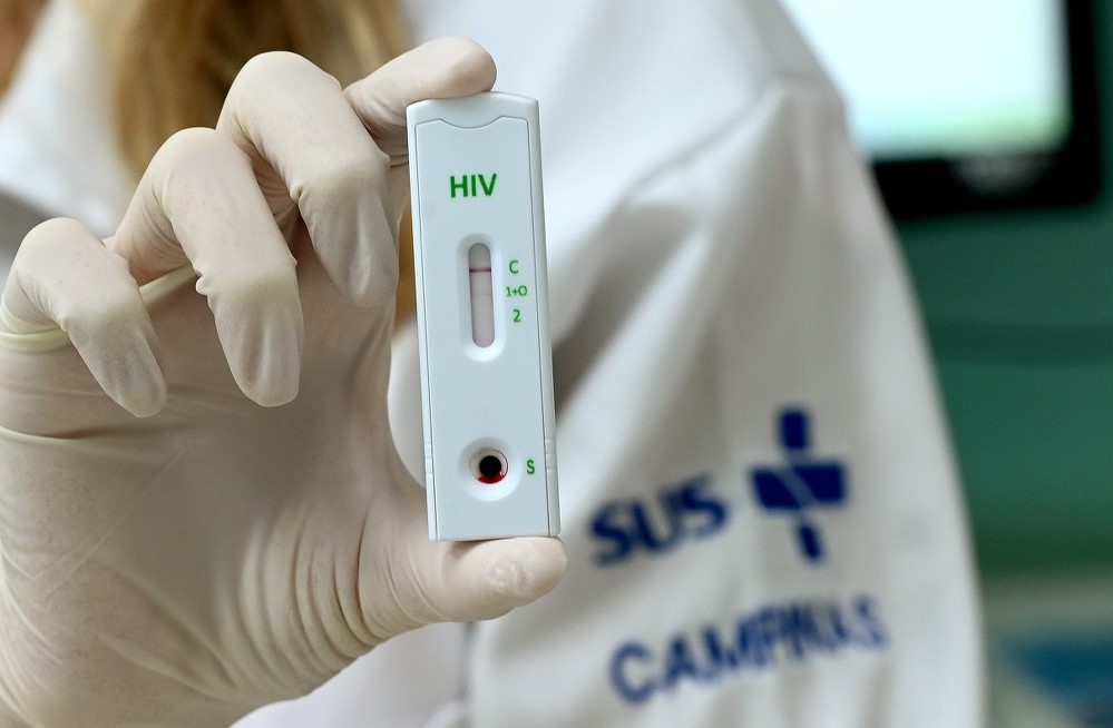 Profissional da saúde exibe teste no Centro de Referência em IST, HIV/Aids e Hepatites Virais