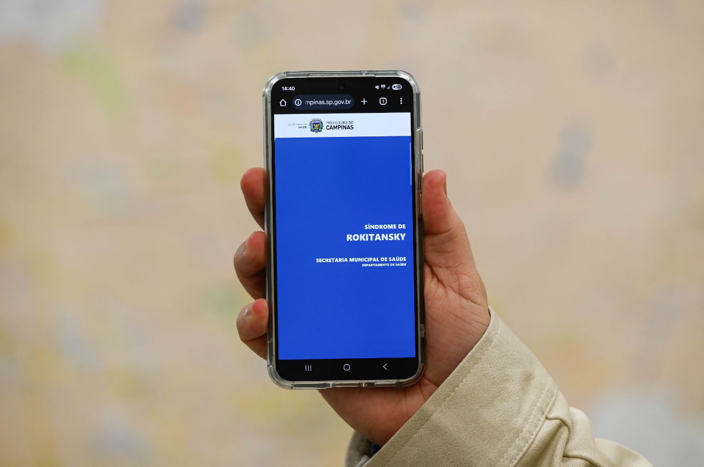Protocolo sobre a síndrome de Rokitansky está disponível no site da Secretaria de Saúde